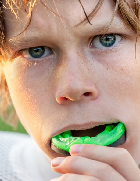 Young boy placing a green athletic mouthguard over his teeth