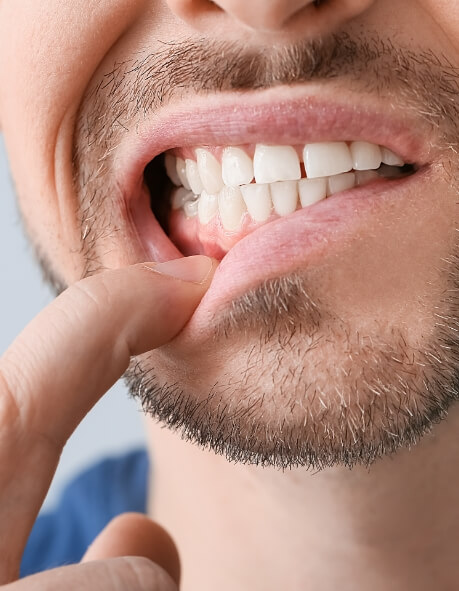 Close up of man pulling down his upper lip to reveal gums