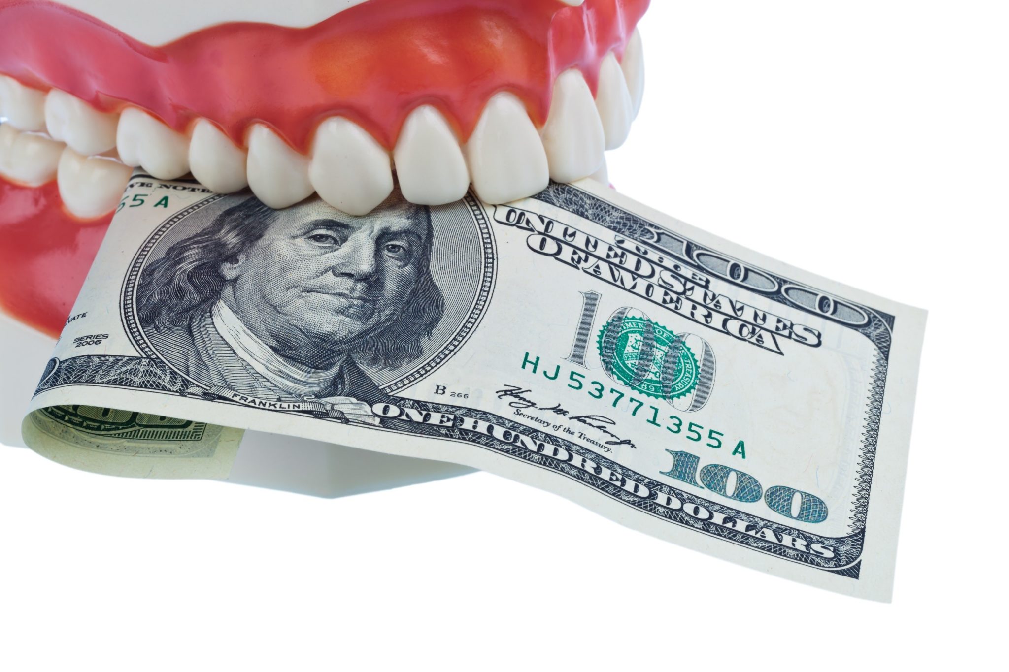 4 Factors Influencing the Cost of Dentures